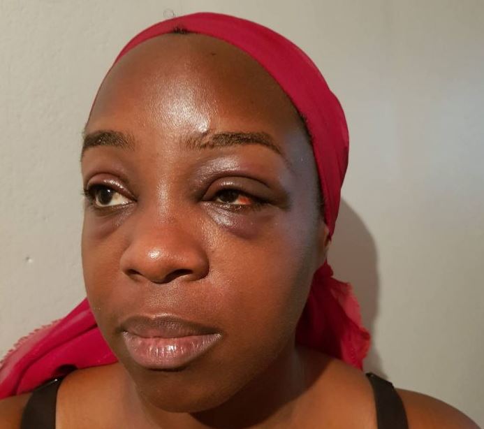 VIDEO: Singer Angella Katatumba Beaten to Near Pulp at Chicken Tonight