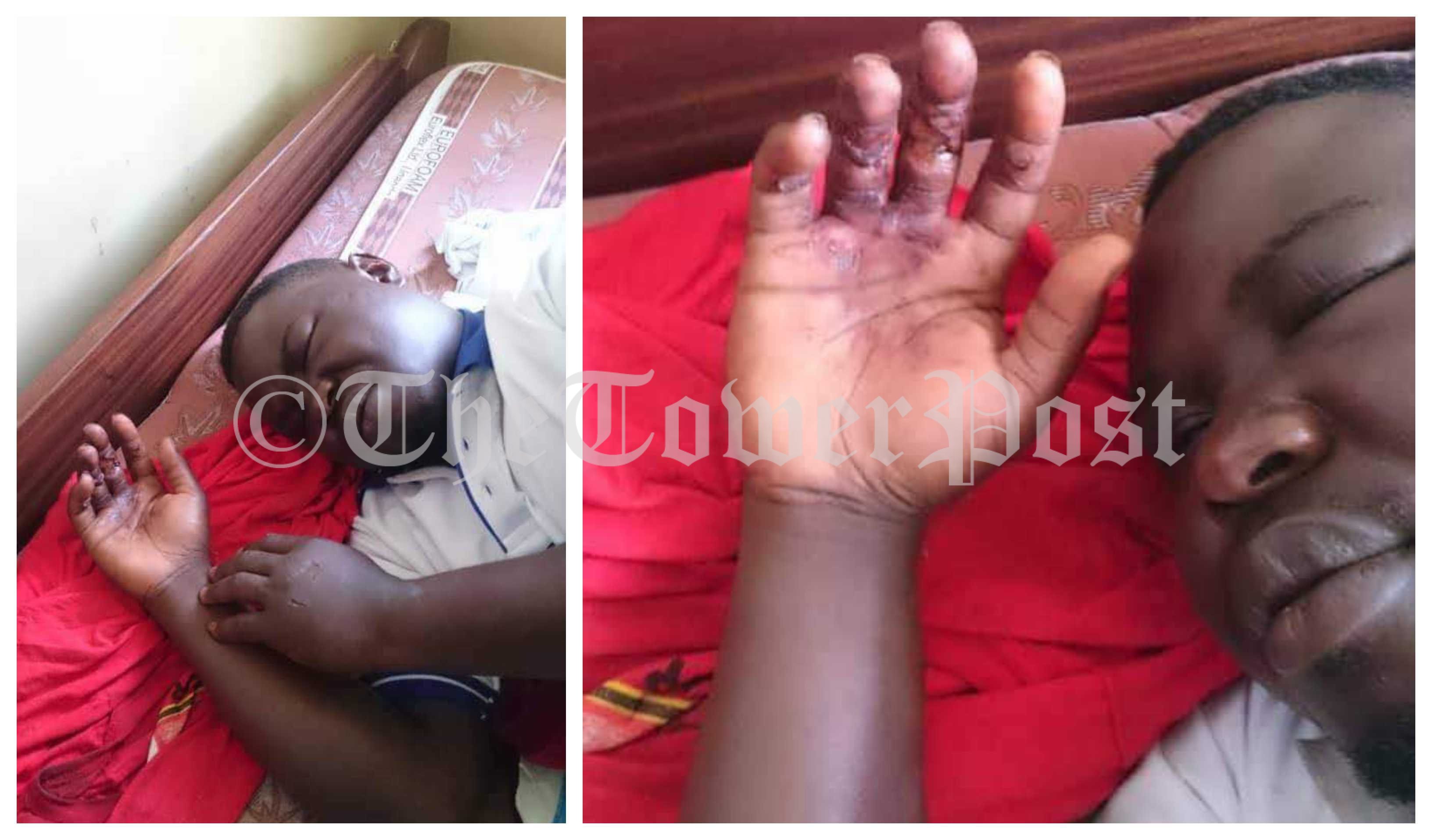 GRAPHIC PHOTOS: MP Zaake Admitted in Critical Conditions