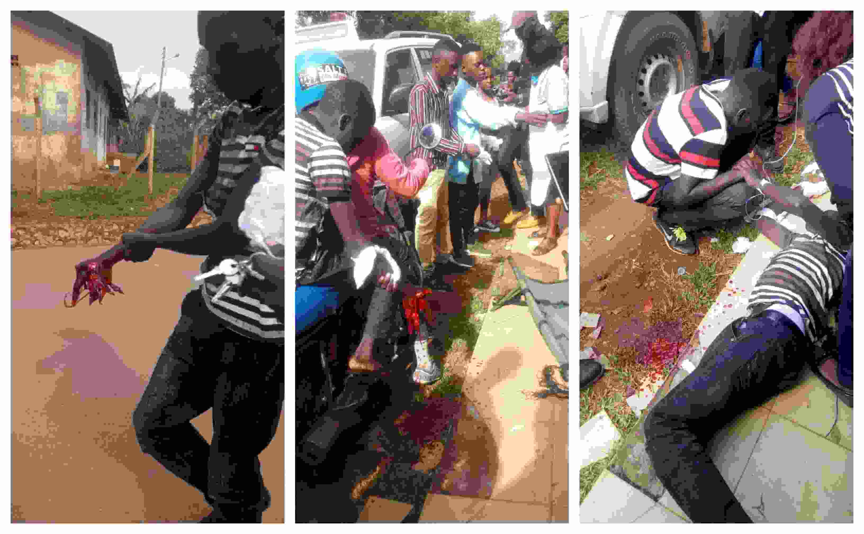 PHOTOS: Student Loses Hand in Kyambogo Strike