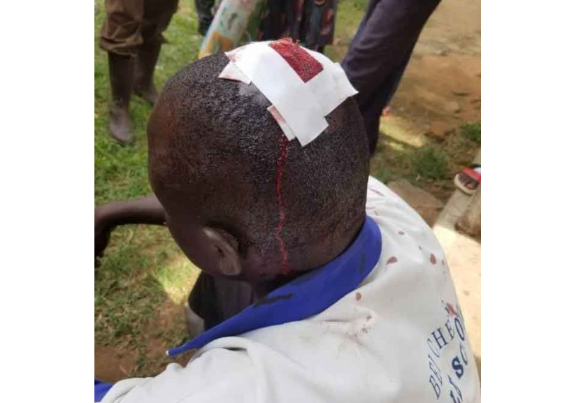 Five Brutally Injured, 18 Arrested in Katakwi NRM Primaries