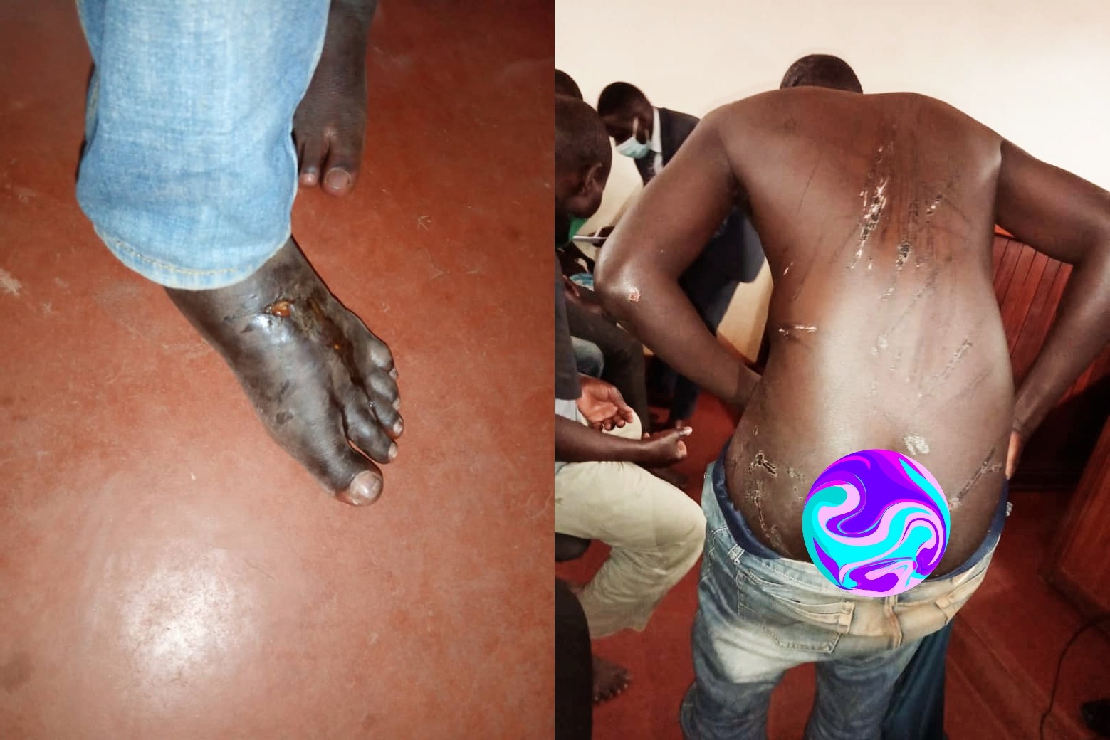 PHOTOS: Katumba Shooting Suspects Tortured in Custody