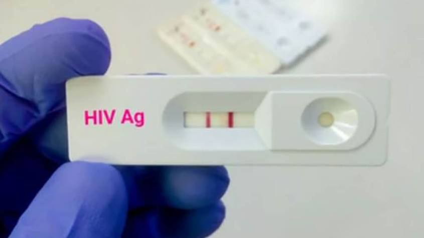 NDA Warns Public From Using Expired HIV Test Kits