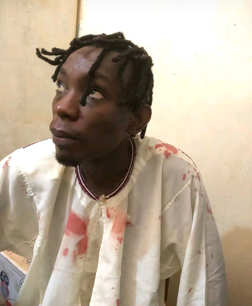 Ugandan Singer Fyno Beaten To Pulp By Thugs
